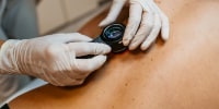 Melanoma vaccine trial appears to reduce skin cancer recurrence