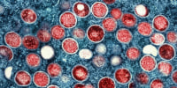 Image: This colorized electron microscope image shows mpox particles, red, found within an infected cell, blue, cultured in a laboratory in Fort Detrick, Md.