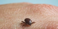 Brown dog tick.