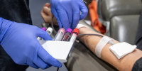 A nurse fills vials with blood in Fullerton, Calif.