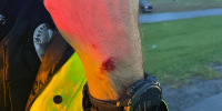 Cut on officer's hand after  incident with golf great Scottie Scheffler