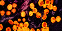 Transmission electron micrograph of monkeypox virus particles 