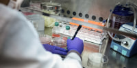 Cell lines are prepared in the laboratory at the National Heart, Lung, and Blood Institute's Cellular and Molecular Therapeutics Laboratory