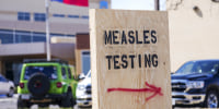 Measles testing in Texas
