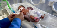 Premature babies.
