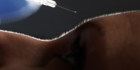 Botox injection