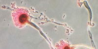 A photomicrograph showing red and pink clumps of fungal matter