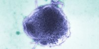 Virus