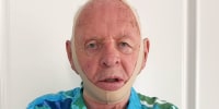 Anthony Hopkins revives Hannibal Lecter character wearing Skims face shapewear.