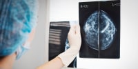 Doctor holding a mammogram in front of x-ray illuminator