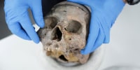A human skull excavated in Colombia