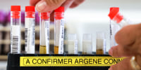 FRANCE-OVERSEAS-HEALTH-VIRUS-CHIKUNGUNYA