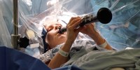 Denise Bacon, 65, plays the clarinet during four hours of Deep Brain Stimulation surgery at  King's College Hospital in London, in images released on Oct. 21, 2025.