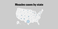 This map shows how many measles cases have been reported per state in U.S. — Texas has the highest concentration, with more than 700 reported cases. New Mexico has the second-most.