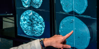 A doctor looks at mammogram imagery.