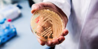 A hand holding a petri dish with yeast inside, thick beige lines are scattered on top of a clear dish