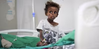 A malnourished child in a gray t-shirt sitting on a hospital bed.