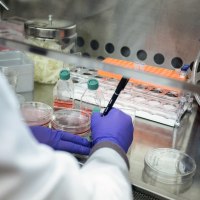 Cell lines are prepared in the laboratory at the National Heart, Lung, and Blood Institute's Cellular and Molecular Therapeutics Laboratory