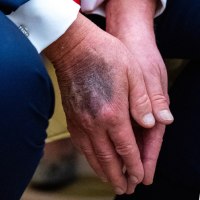 Side by side of a detail shot of Trump's hand and Chris Hayes.