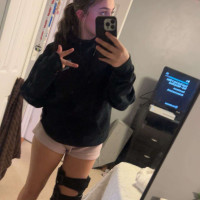 Left: Natalie Silva, a high school senior, is still recovering from a knee injury she sustained when she says her cleats got stuck in the turf on a field her school sometimes uses for soccer. She says her shoes were made to play on grass, not turf. Right: Python Park, a 12-acre field in Avondale Estates, Georgia, features two soccer fields and a diamond for softball and baseball. The field, which belongs to the Paideia School, is replacing grass with turf. 