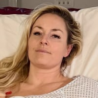 Lindsey Vonn lays on a hospital bed with a metal medical device on her leg to straighten it