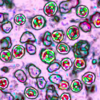 Measles Virus