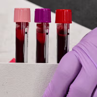 Vials containing blood.