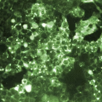 rubeola (measles) virus antigen.