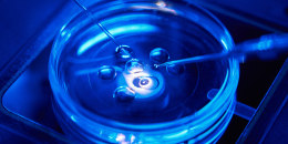 Closeup of intracytoplasmic sperm injection being performed in Petri dish