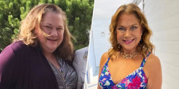 Janet Allen before and after.