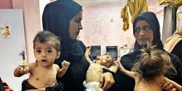 Mothers hold their emaciated children at Nasser Hospital in Khan Yunis, Gaza