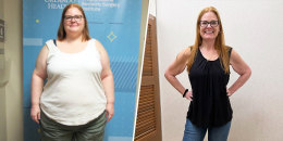 Dorsey Hernandez before and after.