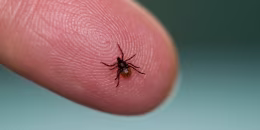 How to remove a tick