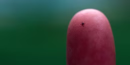 Tick on Fingertip
