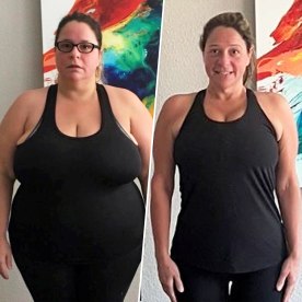 Rebecca Poehlmann before and after