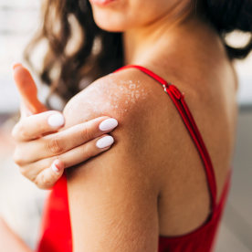 Close up of woman applying moisturizer on sunburned skin.