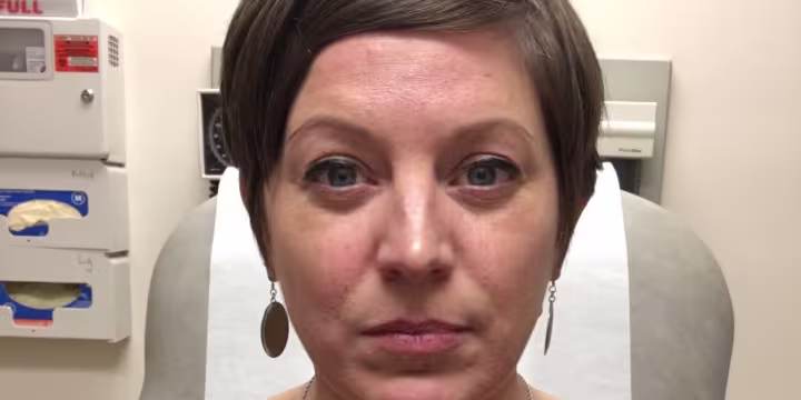 Woman Diagnosed with Rectal Cancer at 42 Reveals Her No. 1 Symptom