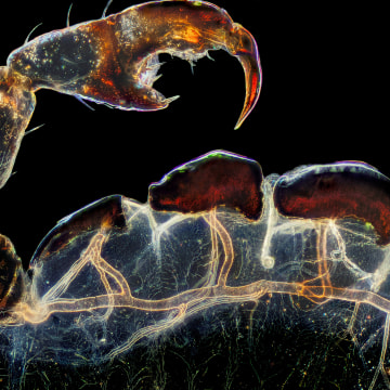 Frank Reiser's photograph of a louse's real leg, claw and respiratory trachea took third place.