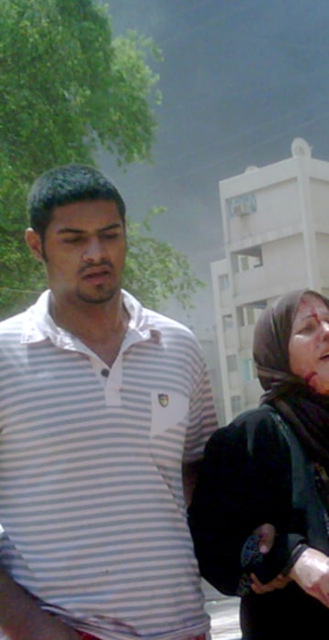 Image: An injured woman at the scene of a bombing in Baghdad