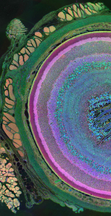 Metabolomic Eye 
Computational Molecular Phenotyping (CMP) of a mouse eye made with a glancing oblique section through the retina with taurine, glutamine and glutamate assigned to red, green and blue color channels respectively. In this image, the optic nerve head can be seen in the upper right portion of the image with the rectus muscles (red/gold) attaching to the sclera (green) on the upper left portion of the image and an oblique muscle in the lower left of the image. Concentric rings of retinal layers are then represented from the sclera through to the vascular choroid, the retinal pigment epithelium (light gold), photoreceptor outer segments (dark pink), photoreceptor inner segments (light pink), photoreceptor cell bodies, bipolar cells (shades of purple/pink), amacrine cells (varying shades of blue/light green/red), inner plexiform layer (fine filigree of purple, blue and green), ganglion cell layer (varying shades of blue/green), and the optic fiber layer (blue structures at center of image).