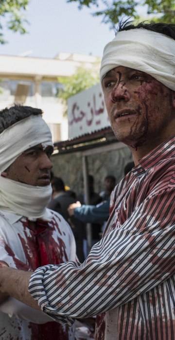 Image: Two injured men leave a hospital after receiving first aid treatment, a few blocks away from where a truck bomb exploded in central Kabul, Afghanistan.
