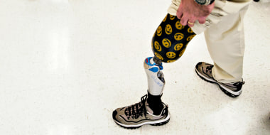 WASHINGTON - JANUARY 7; DAV member William Sturges displays his custom design on his prosthetic leg as members of the Disabled American Veterans visit wounded soldiers who have recently returned from Iraq and are now recieving treatment at Walter Reed Army Medical Center in Washington, DC on January 7, 2005.