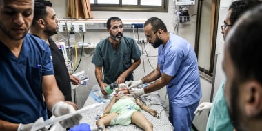 Doctors examine a child injured during an Israeli attack at Nasser Hospital in Khan Yunis, Gaza on Oct. 13, 2023. 