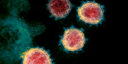 Esta imagen de un microscopio electrónico sin fecha, facilitada por los Institutos Nacionales de Salud de EE.UU. en febrero de 2020, muestra el virus que causa el COVID-19.
