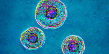 Los micoplasmas son pequeñas bacterias ubicuas, sin paredes celulares, responsables de infecciones respiratorias o urinarias.