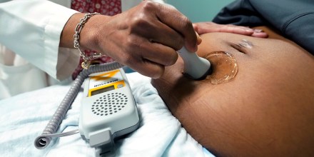 A doctor uses a hand-held Doppler probe on a pregnant woman to measure the heartbeat of the fetus, in Jackson, Mississippi, on Dec. 17, 2021.