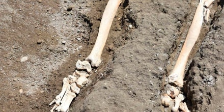 Esqueleto Vesubio