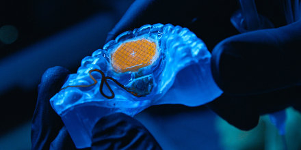 Augmental MouthPad