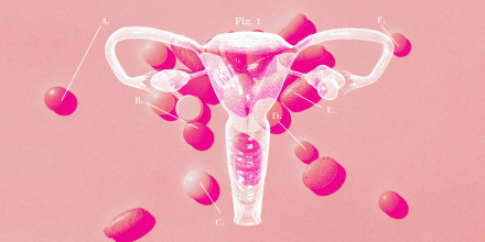 Photo illustration of female reproductive system and scattered pills 