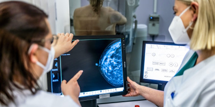 Medical personnel use a mammogram to examine a woman's breast for breast cancer.